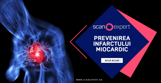 Prevenirea infarctului miocardic prin metode moderne de investigatie de imagistica medicala – Computer Tomografie