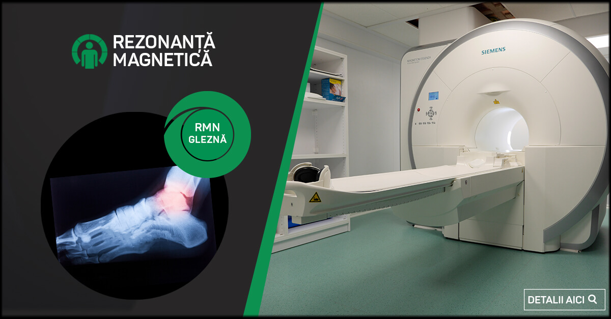 Diagnosticul RMN al bolilor articulare tratamentul artrozei în serbia